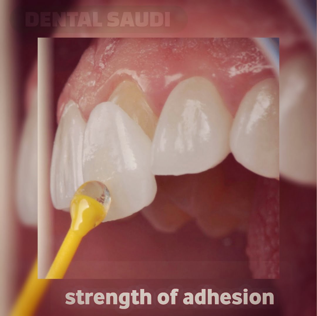 strength of adhesion
